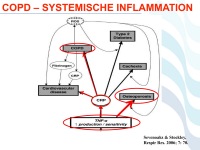 Abbildung 45: COPD - Osteoporose