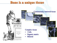 Abbildung 53: COPD - Osteoporose