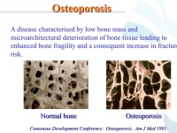Abbildung 55: COPD - Osteoporose