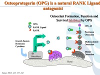Abbildung 60: COPD - Osteoporose
