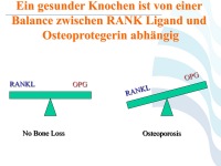 Abbildung 61: COPD - Osteoporose