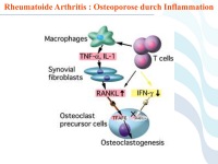 Abbildung 63: COPD - Osteoporose
