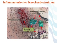 Abbildung 65: COPD - Osteoporose