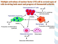 Abbildung 69: COPD - Osteoporose