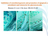 Abbildung 72: COPD - Osteoporose