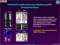 Abbildung 3: Knochenmasse