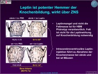 Abbildung 4: Knochenmasse