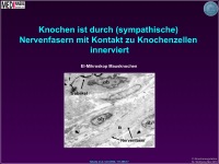Abbildung 8: Knochenmasse