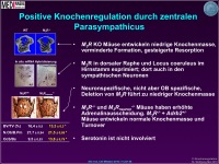 Abbildung 19: Knochenmasse