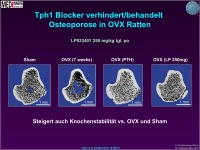 Abbildung 28: Knochenmasse