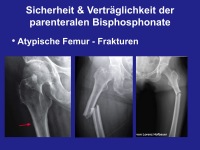 Abbildung 10: Parenterale Bisphosphonate