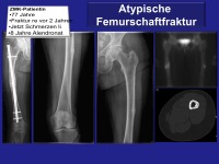 Abbildung 11: Parenterale Bisphosphonate