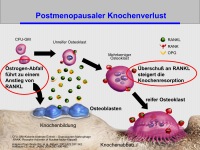 Abbildung 4: HRT- Osteologie