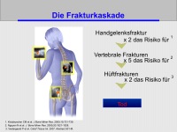 Abbildung 6: HRT- Osteologie