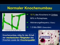 Abbildung 12: SERMS