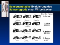 Abbildung 20: SERMS