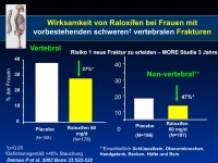 Abbildung 22: SERMS