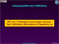 Abbildung 9: Osteoporose