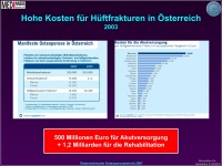 Abbildung 12: Osteoporose