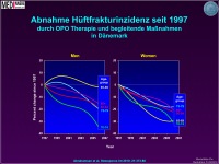 Abbildung 17: Osteoporose