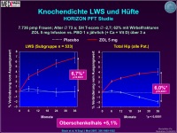 Abbildung 21: Osteoporose