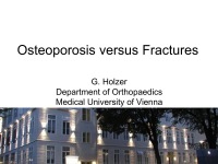 Abbildung 1: Osteoporose - Frakturen