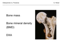 Abbildung 4: Osteoporose - Frakturen