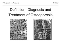 Abbildung 9: Osteoporose - Frakturen