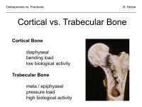 Abbildung 12: Osteoporose - Frakturen