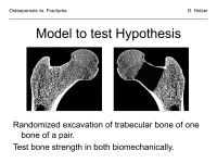 Abbildung 14: Osteoporose - Frakturen