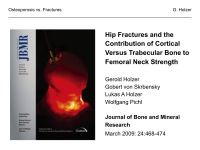 Abbildung 39: Osteoporose - Frakturen
