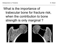 Abbildung 43: Osteoporose - Frakturen