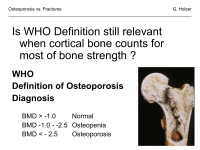Abbildung 45: Osteoporose - Frakturen
