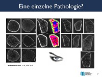Abbildung 7: Osteoporose-Assessment