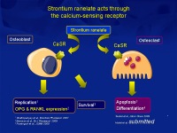 Abbildung 4: Osteoporose-Assessment