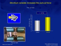 Abbildung 14: Osteoporose-Assessment