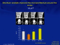 Abbildung 19: Osteoporose-Assessment