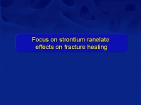 Abbildung 21: Osteoporose-Assessment