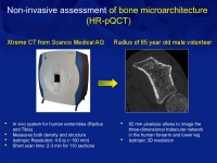 Abbildung 30: Osteoporose-Assessment