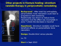 Abbildung 52: Osteoporose-Assessment