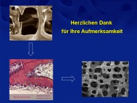 Abbildung 53: Osteoporose-Assessment