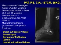 Abbildung 14: M�nnliche Osteoporose