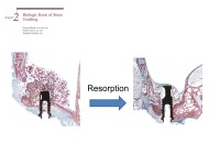 Abbildung 12: Bisphosphonate