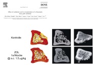 Abbildung 13: Bisphosphonate