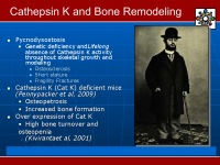 Abbildung 7: Kathepsin K