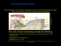 Abbildung 15: Osteoporose