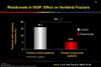 Abbildung 32: Osteoporose