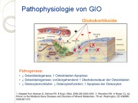 Abbildung 4: Glukokortikoidinduzierte Osteoporose