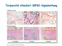 Abbildung 9: Anabole Osteoporosetherapie