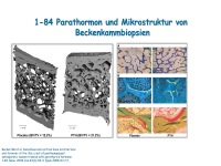 Abbildung 20: Anabole Osteoporosetherapie